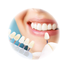 医療ホワイトニング