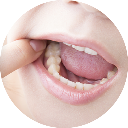 むやみに削りません