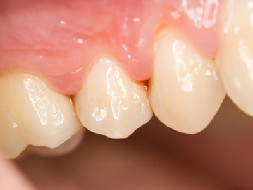 撮影した口腔内の画像