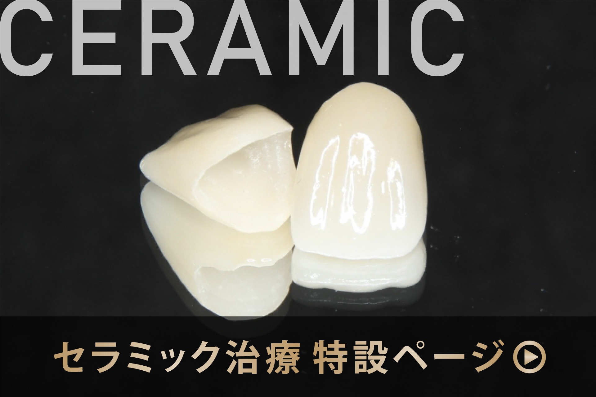 セラミック治療